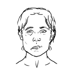 Care sunt simptomele unui accident vascular cerebral?