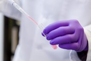 Măsurarea activității pepsinei